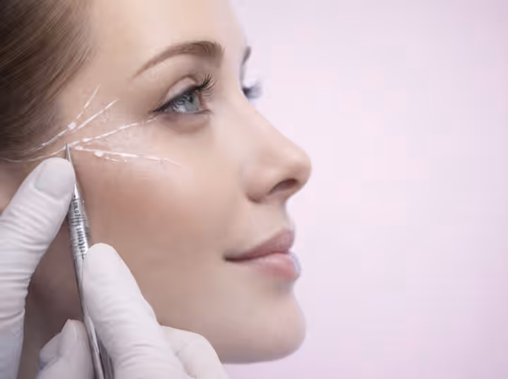 İp Askı ile Göz Çevresi Estetiği